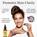 PURA D'OR Organic Evening Primrose Oil (4oz) 100% Pure Cold Pressed w/Natural Essential Fatty Acids & Antioxidant Rich - Moisturizes, Rejuvenates, Renews & Restores - Skin, Hair & Face PURA D'OR