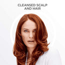 Nioxin System 3 Cleanser Shampoo, Color Treated Hair with Light Thinning, 10.1 oz Nioxin