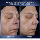 Lancôme Génifique Ultimate Dual Recovery Face Serum- Anti-Aging Serum Visibly Improves Fine Lines, Rough Texture, Plumpness and Even Skintone - with Beta Glucan and, Hyaluronic Acid Infinity Warehouse