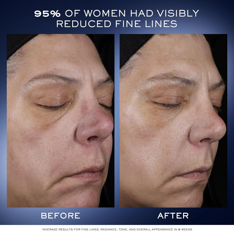 Lancôme Génifique Ultimate Dual Recovery Face Serum- Anti-Aging Serum Visibly Improves Fine Lines, Rough Texture, Plumpness and Even Skintone - with Beta Glucan and, Hyaluronic Acid Infinity Warehouse