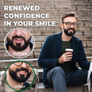 Amazing Temporary Tooth Replacement Kit Temp Dental Repair Amazing Temporary Tooth
