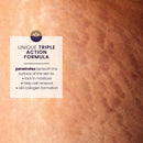 Mederma Stretch Marks Therapy - Help Prevent and treat Stretch Marks -