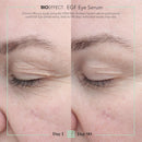 BIOEFFECT EGF Eye Serum with De-Puffer Rollerball | Age-Defying Under Eye Treatment with Epidermal Growth Factor for Fine Lines, Wrinkles, Puffiness & Sagging 6 mL / 0.20 oz Infinity Warehouse