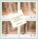 Saw Palmetto Follicle Boost Scalp Serum for Thinning Hair, Clinically Tested Hair & Scalp Treatment, Drug-Free Hormone-Free, Non-Greasy Formula with Peptides, Caffeine & Biotin Infinity Warehouse