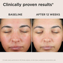 EltaMD UV Skin Recovery Face Sunscreen with Zinc Oxide, All Mineral, Safe for Sensitive Skin SPF 50 Infinity Warehouse