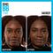 Maybelline Dream Pure Skin Clearing BB Cream, 8-in-1 Skin Perfecting Beauty Balm With 2% Salicylic Acid, Sheer Tint Coverage, Oil-Free, Deep, 1 Fl Oz Maybelline New York