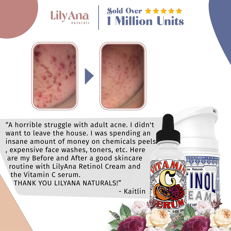 LilyAna Naturals Retinol Cream Moisturizer 1.7 Oz and Vitamin C Serum 1 Oz Bundle - For Face and Eyes, Men and Women - Daily use for Acne, Anti Wrinkle, Anti Aging, Fades Age Spots and Sun Damage LilyAna Naturals