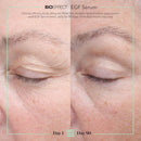 BIOEFFECT EGF Serum | Epidermal Growth Factor + Hyaluronic Acid | Age-Defying Face Treatment for Fine Lines & Wrinkles, Hydration & Firmness, 20 mL / 0.68 oz Infinity Warehouse