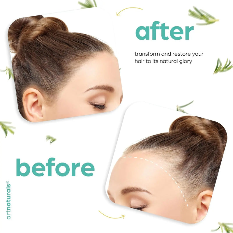 ArtNaturals Organic Rosemary & Castor Hair Growth Oil + Scalp Massager Set – Hair Styling Oils for Dry, Itchy Scalp, Thickening & Hydration - Scalp Oil Products For Damaged Hair & Split Ends – 4.0 oz Infinity Warehouse