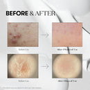 VT COSMETICS CICA Reedle Shot 50, Day&Night Mild Exosome, Microneedling Serum, Centella Asiatica, Hyaluronic Acid, Exfoliation, Soft & Glass Skin, Korean Skin Booster 1.69Fl Oz(50ml) Infinity Warehouse