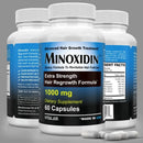 2X Official Minoxidine 1000mg Advanced Hair Growth -30, 60 tablet/ 120 tablet Infinity Warehouse