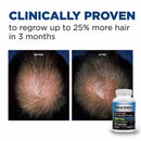 2X Official Minoxidine 1000mg Advanced Hair Growth -30, 60 tablet/ 120 tablet Infinity Warehouse